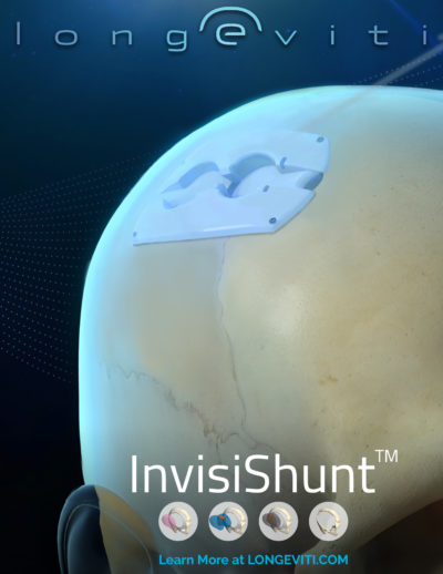 Edit InvisiShunt Skull Model