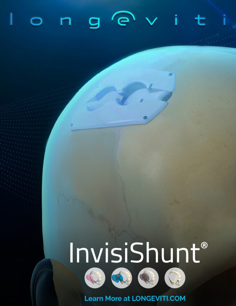 InvisiShunt Brochure 051619_Page_1 InvisiShunt Skull Model